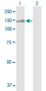 NCAM2 Antibody in Western Blot (WB)