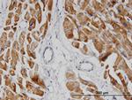 NDUFA8 Antibody in Immunohistochemistry (Paraffin) (IHC (P))