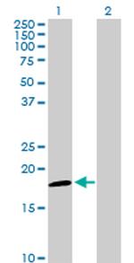 NDUFAB1 Antibody in Western Blot (WB)