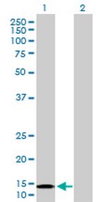 NDUFB6 Antibody in Western Blot (WB)