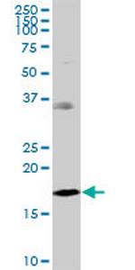 NDUFB7 Antibody in Western Blot (WB)