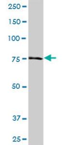 NDUFS1 Antibody in Western Blot (WB)