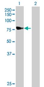 NDUFS1 Antibody in Western Blot (WB)