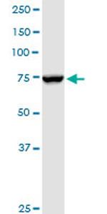 NDUFS1 Antibody in Western Blot (WB)