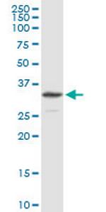 NDUFS3 Antibody in Western Blot (WB)