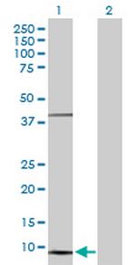 NDUFS5 Antibody in Western Blot (WB)