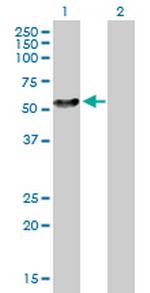 NEK2 Antibody in Western Blot (WB)