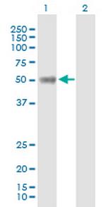 NEUROD1 Antibody in Western Blot (WB)