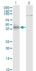 NEUROD1 Antibody in Western Blot (WB)