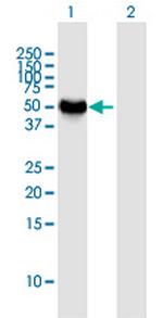 NEUROD2 Antibody in Western Blot (WB)