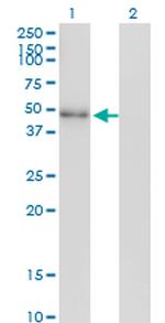 NEUROD2 Antibody in Western Blot (WB)