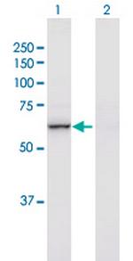 NF2 Antibody in Western Blot (WB)