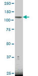 NFKB1 Antibody in Western Blot (WB)