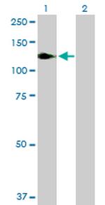 NFKB1 Antibody in Western Blot (WB)