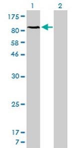 NFKB1 Antibody in Western Blot (WB)