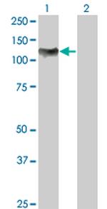 NFKB1 Antibody in Western Blot (WB)