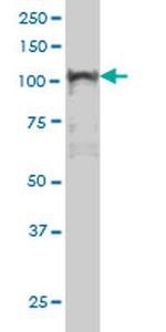 NFKB1 Antibody in Western Blot (WB)