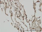 NFKBIB Antibody in Immunohistochemistry (Paraffin) (IHC (P))