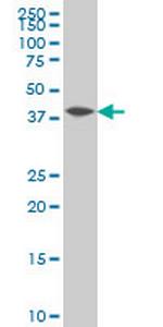 NFKBIB Antibody in Western Blot (WB)