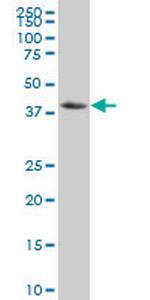 NFKBIB Antibody in Western Blot (WB)