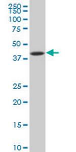 NFKBIB Antibody in Western Blot (WB)