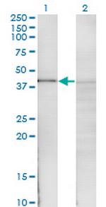 NFKBIB Antibody in Western Blot (WB)