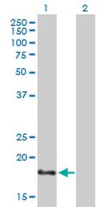 NHLH1 Antibody in Western Blot (WB)