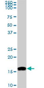 NME2 Antibody in Western Blot (WB)