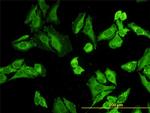 NODAL Antibody in Immunocytochemistry (ICC/IF)