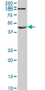 NODAL Antibody in Western Blot (WB)