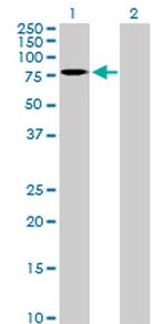 CNOT2 Antibody in Western Blot (WB)