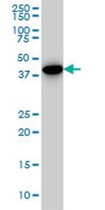 CNOT2 Antibody in Western Blot (WB)