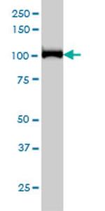 CNOT3 Antibody in Western Blot (WB)