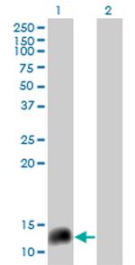 NPY Antibody in Western Blot (WB)