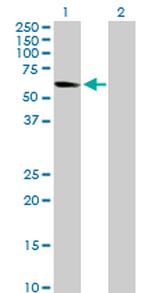 NRF1 Antibody in Western Blot (WB)