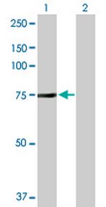 NSF Antibody in Western Blot (WB)