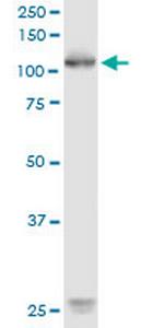 ROR1 Antibody in Western Blot (WB)