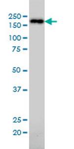 NUMA1 Antibody in Western Blot (WB)