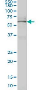 NR4A2 Antibody in Western Blot (WB)