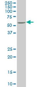 NR4A2 Antibody in Western Blot (WB)