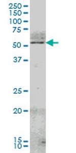 NR4A2 Antibody in Western Blot (WB)