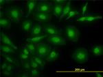 NR4A2 Antibody in Immunocytochemistry (ICC/IF)