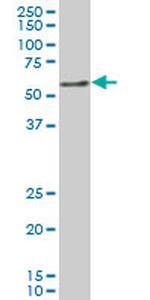 NR4A2 Antibody in Western Blot (WB)