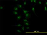 NR4A2 Antibody in Immunocytochemistry (ICC/IF)