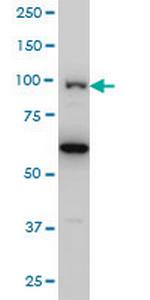 OCRL Antibody in Western Blot (WB)