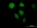 OGG1 Antibody in Immunocytochemistry (ICC/IF)