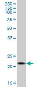 OGG1 Antibody in Western Blot (WB)