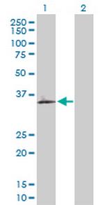 OLR1 Antibody in Western Blot (WB)