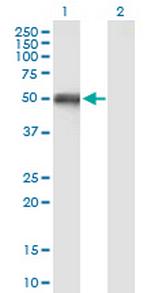 OXCT1 Antibody in Western Blot (WB)