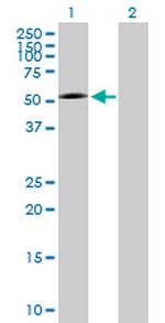 P2RX5 Antibody in Western Blot (WB)